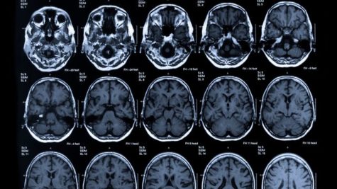 The Importance of Neuroimaging for The Criminal Justice System.