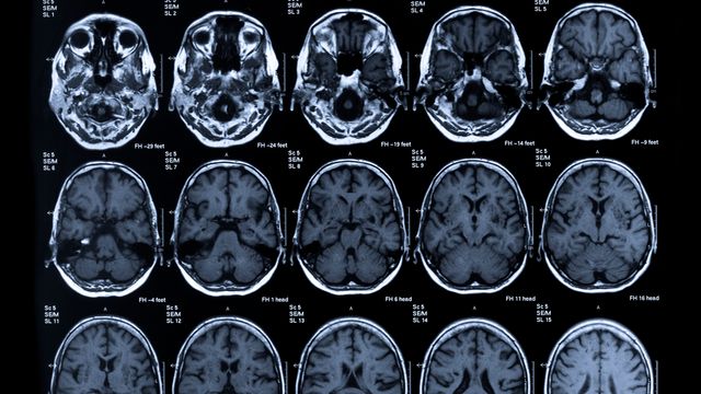The+Importance+of+Neuroimaging+for+The+Criminal+Justice+System.